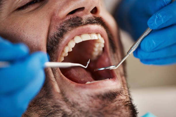 Best Emergency Broken Tooth Repair in Glencoe, FL